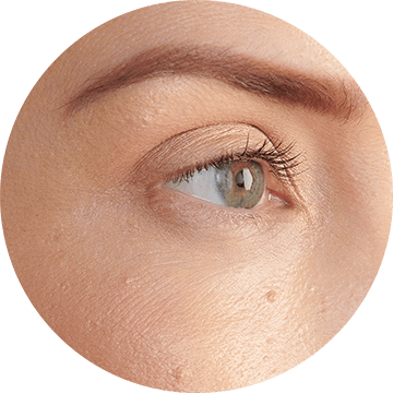 aging-spots-image