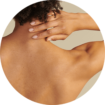 body-acne-image