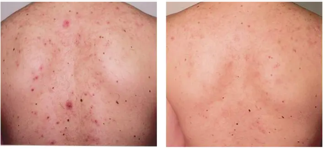 body-revive-before-after