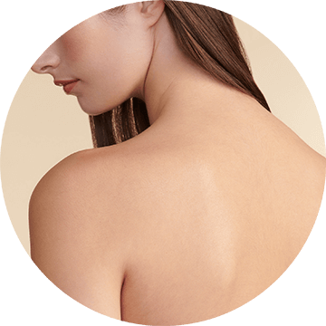 body-sun-damage-image
