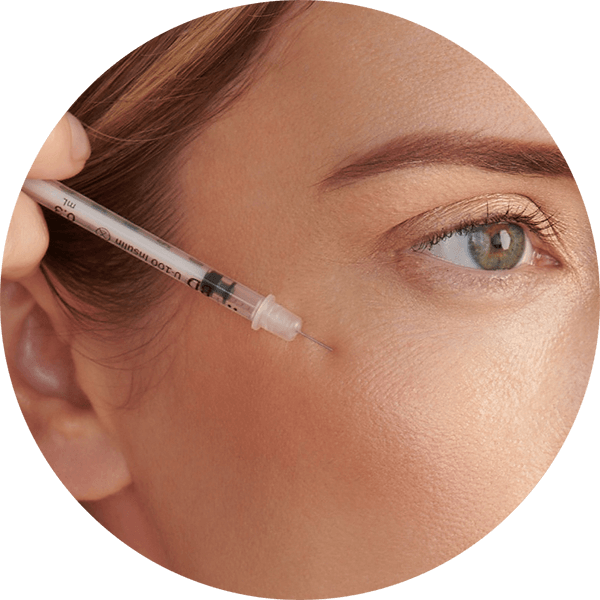 botox treatment