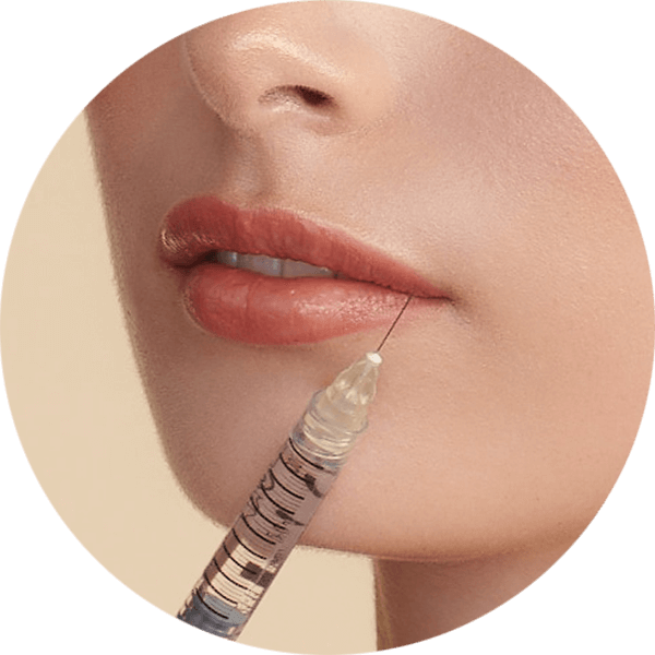 dermal-filler