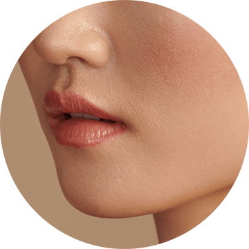 enlarged-pores-image
