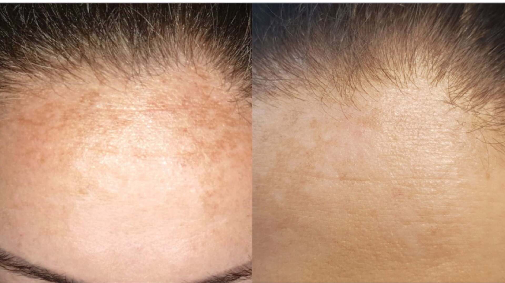 skin-glow-before-after-3