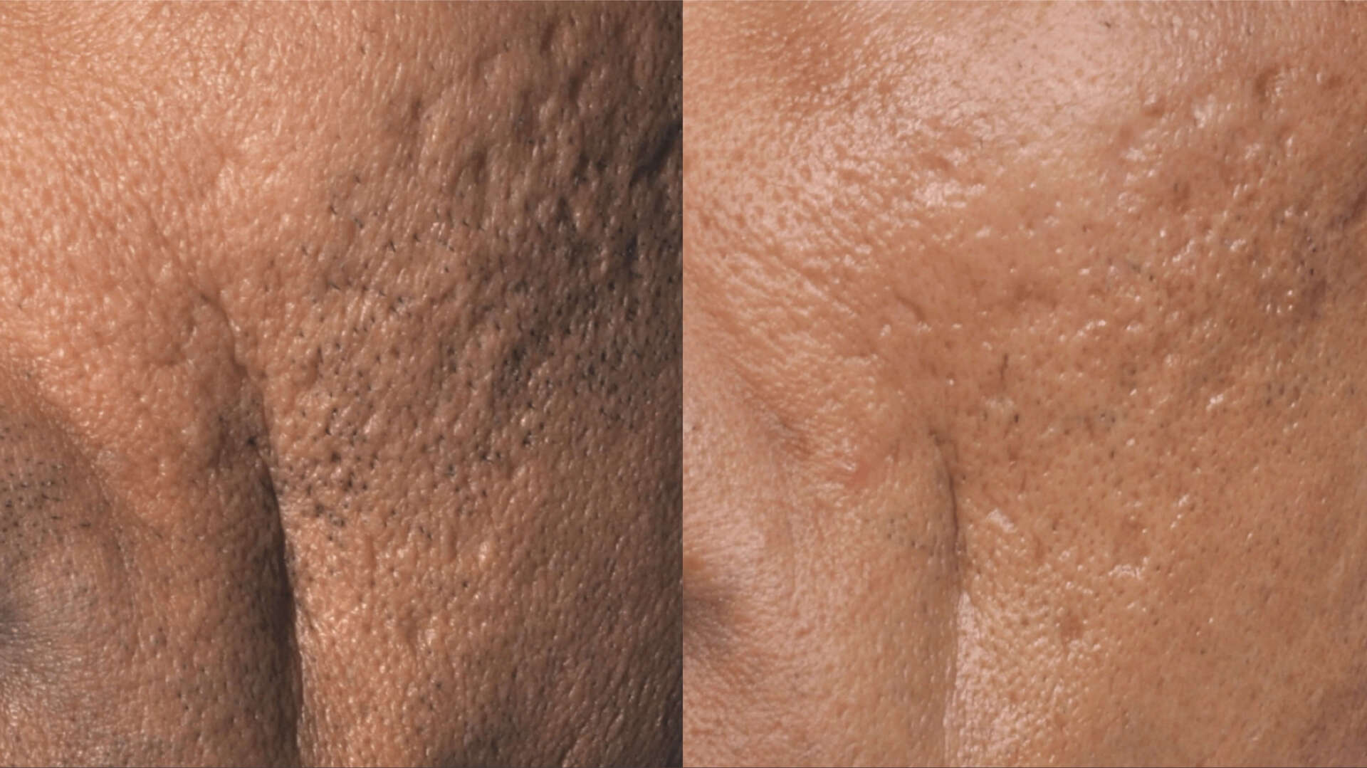 skin-revive-before-after-1