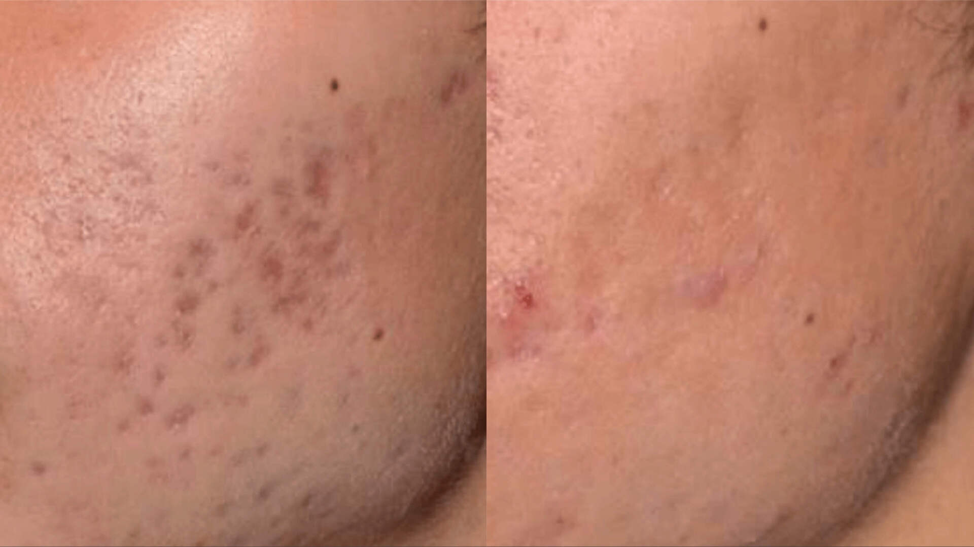 skin-revive-before-after-2