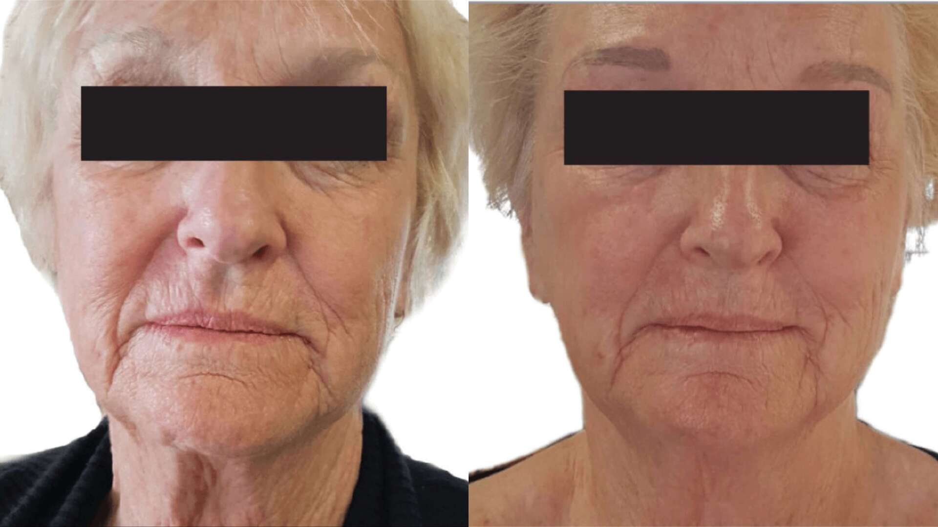 skin-revive-before-after-3