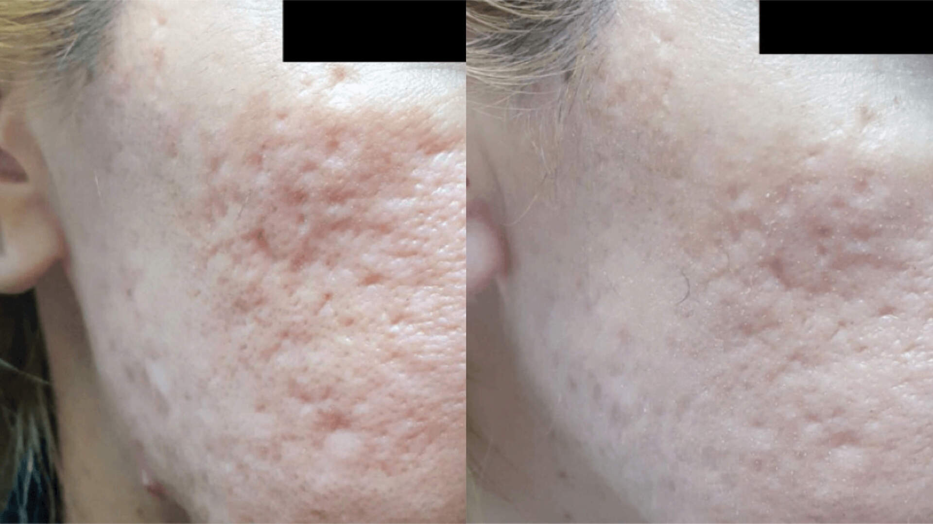 skin-revive-before-after-4