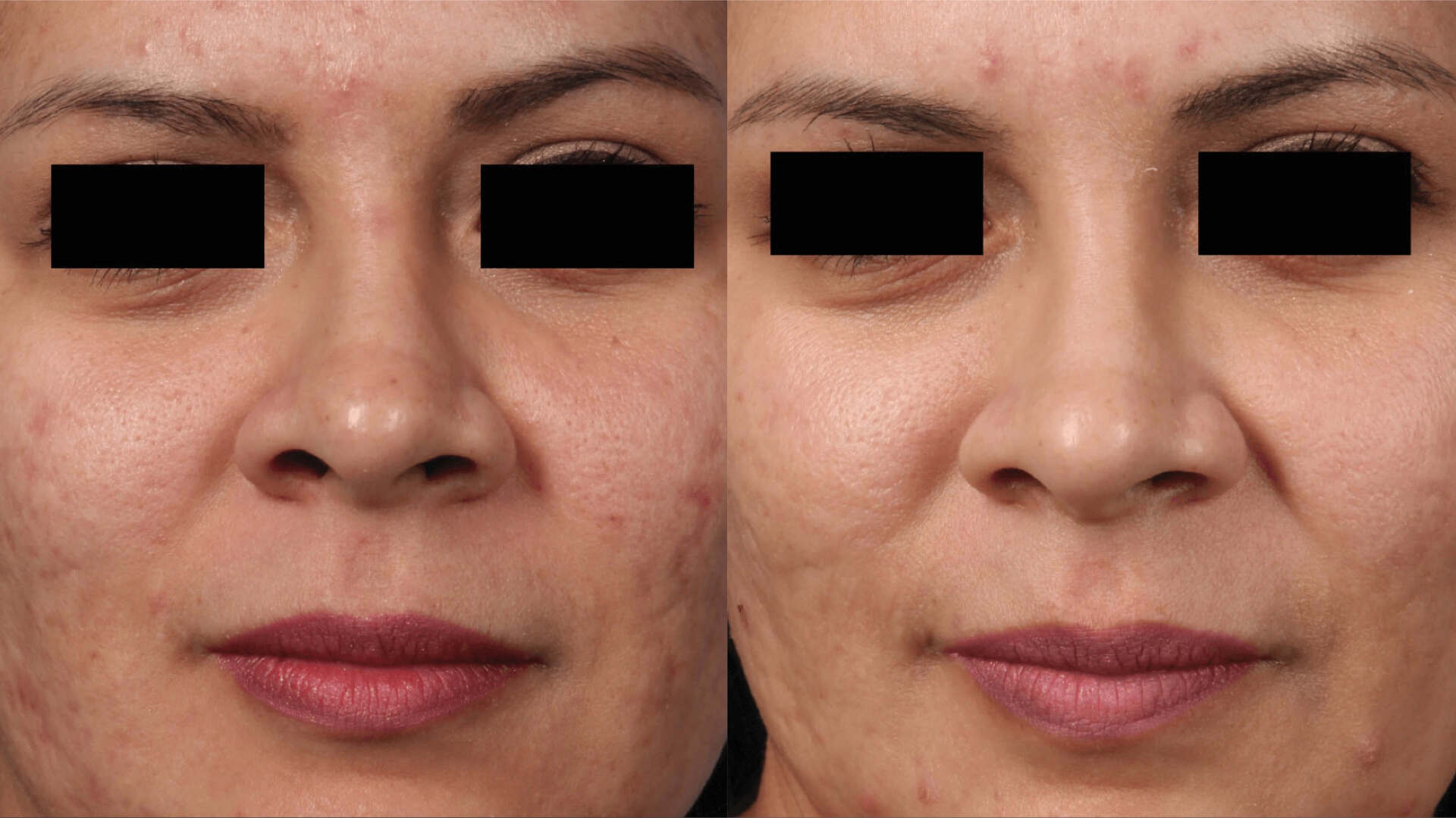 skin-revive-before-after-5