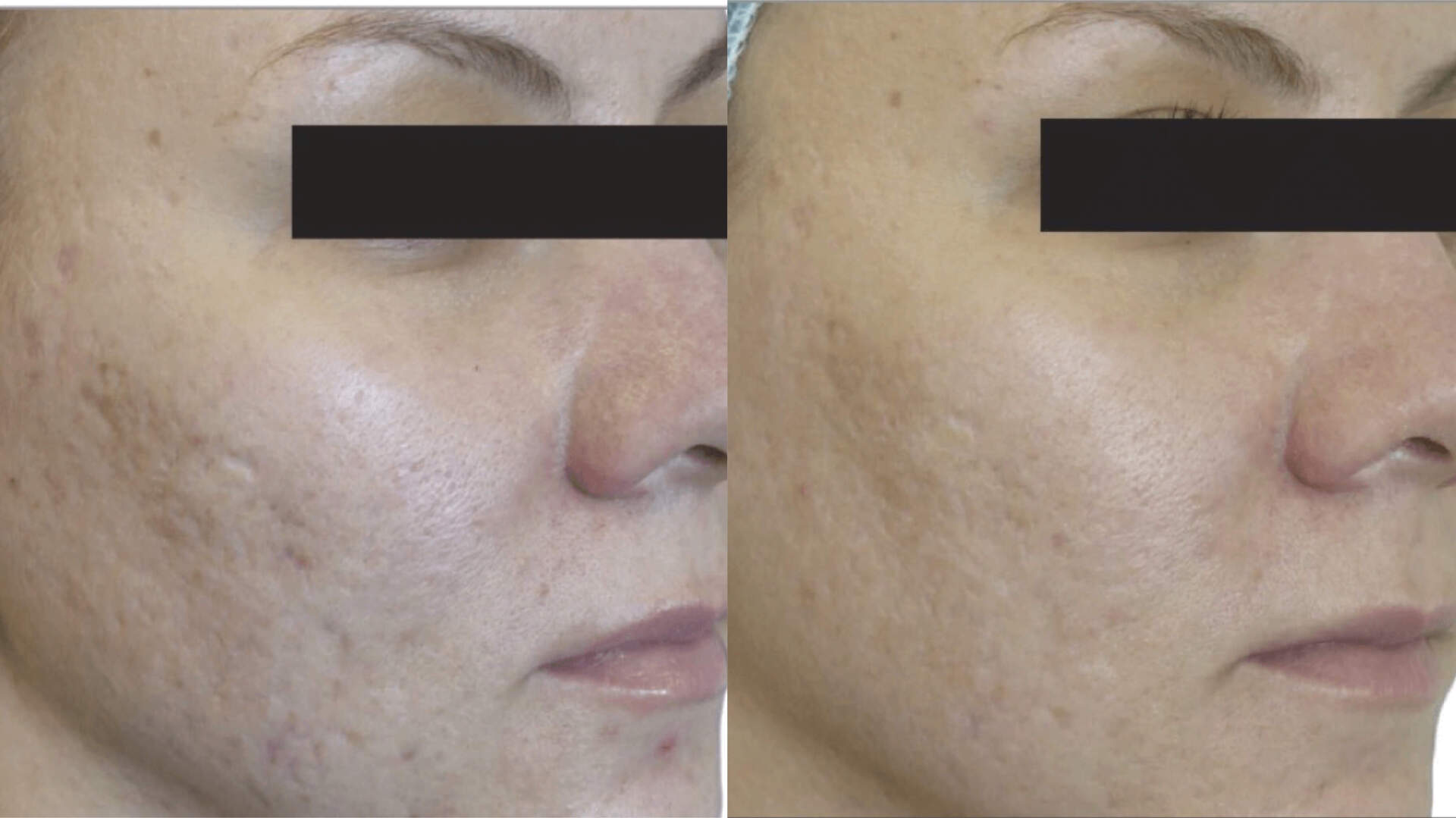 skin-revive-before-after-6
